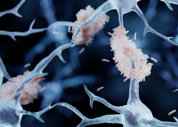Omstreden Chinese Alzheimer-operatie verboden na duizenden ingrepen