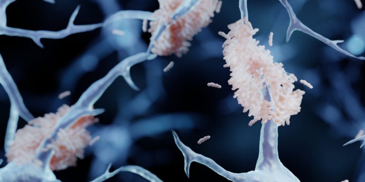 Omstreden Chinese Alzheimer-operatie verboden na duizenden ingrepen